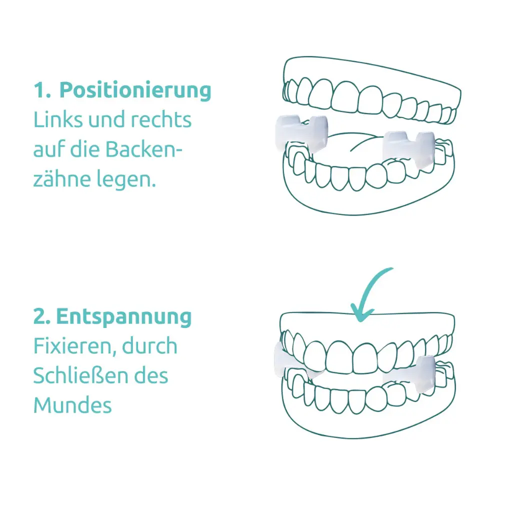 TJ-Motion Aligner Gr. B 5,5